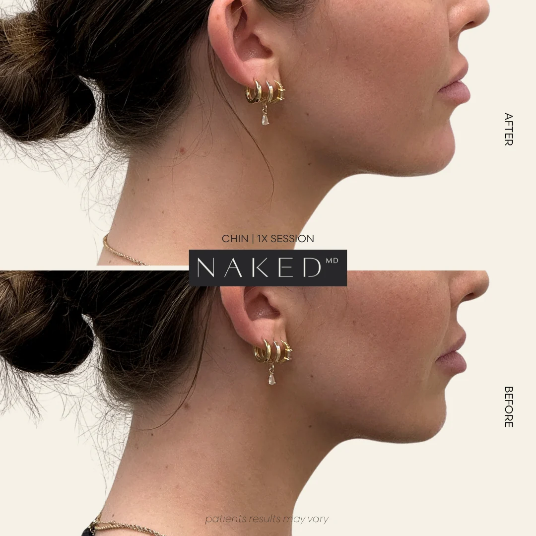 CollaGel - Image 10