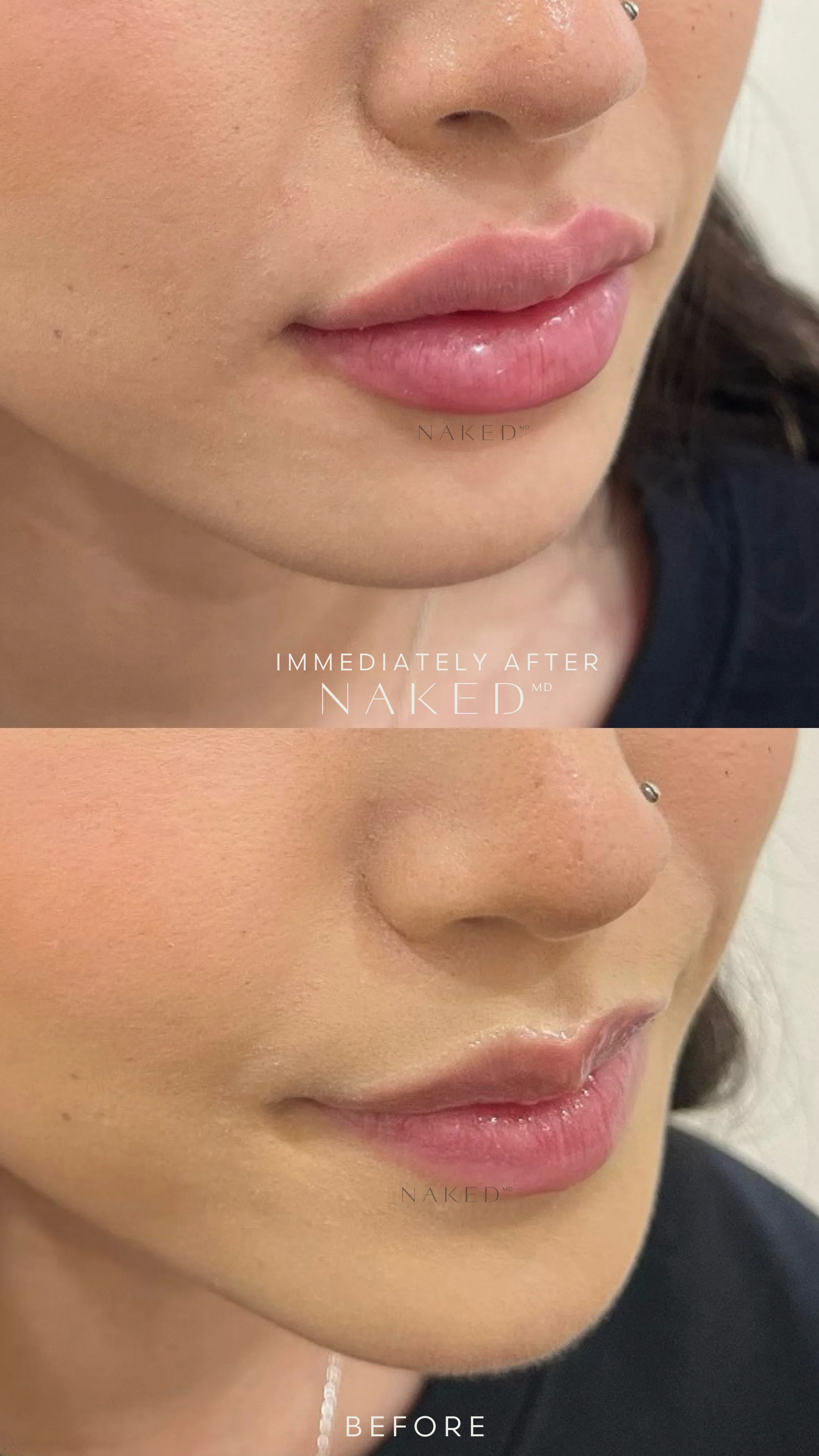 Naked Lips | Lip Filler - NV - Image 45