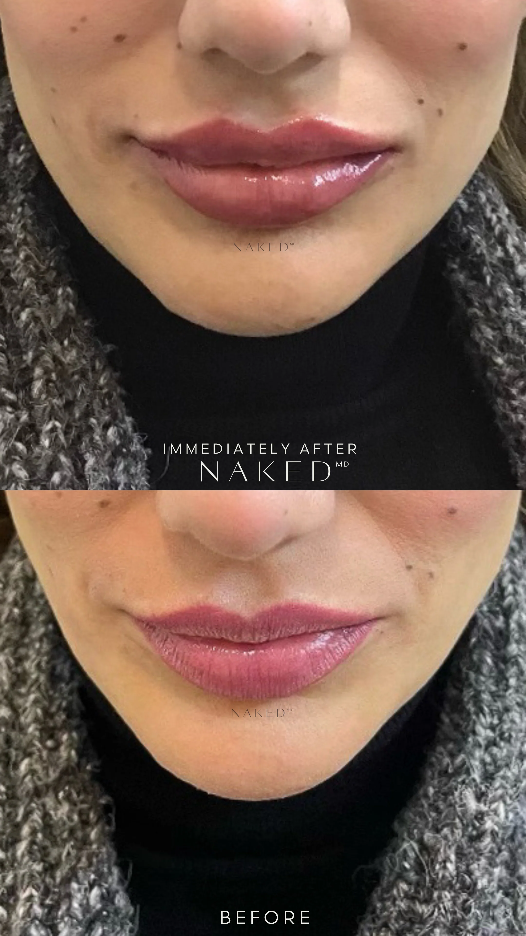 Naked Lips | Lip Filler - NV - Image 46