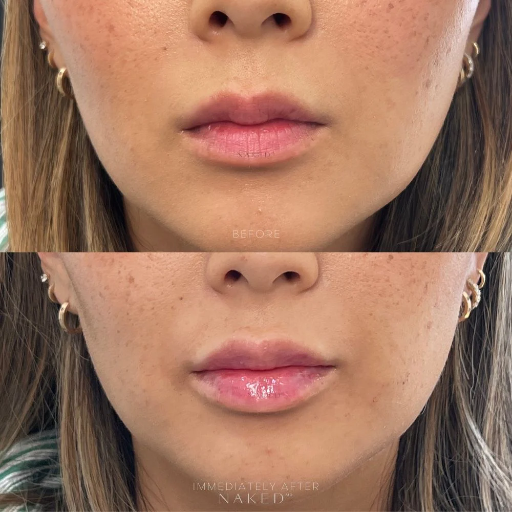 Naked Lips | Lip Filler - NV - Image 48