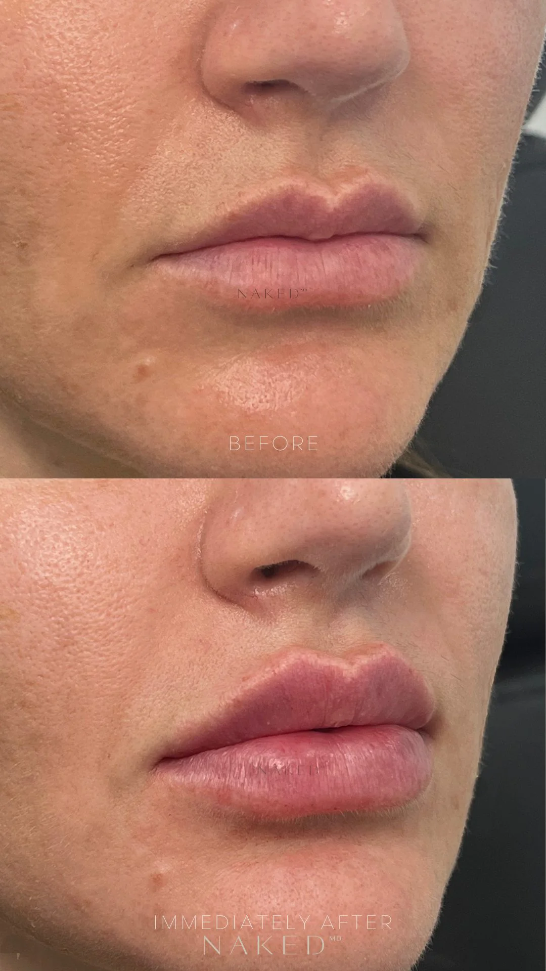 Naked Lips | Lip Filler - NV - Image 28